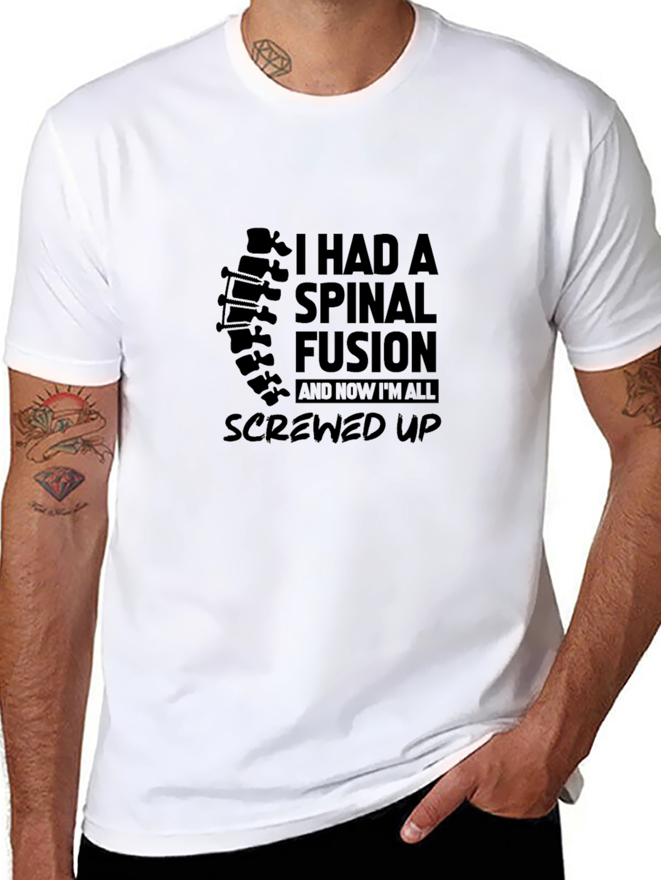Spinal Fusion T-Shirt - Screw Up Tee