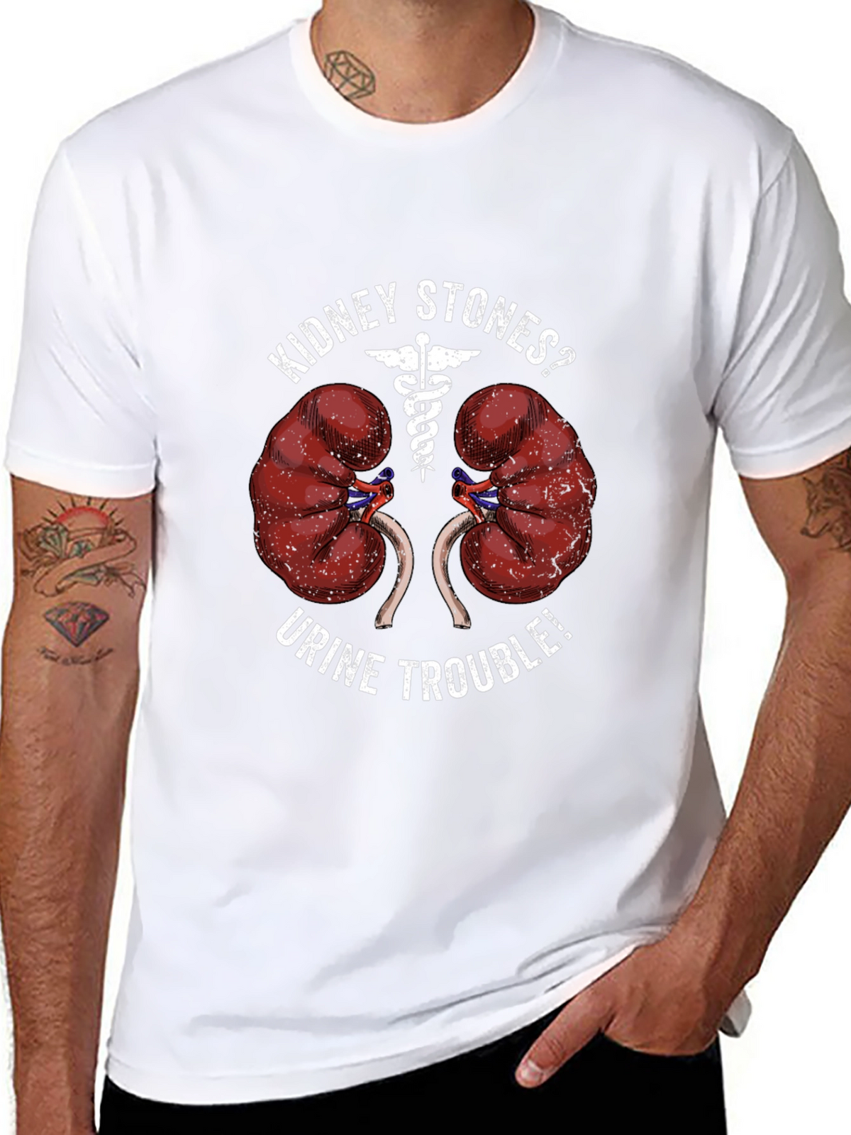 Kidney Stones? Graphic Tee - Urology Humor T-Shirt